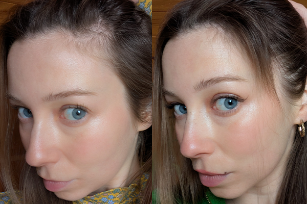 Hair before and after biotin