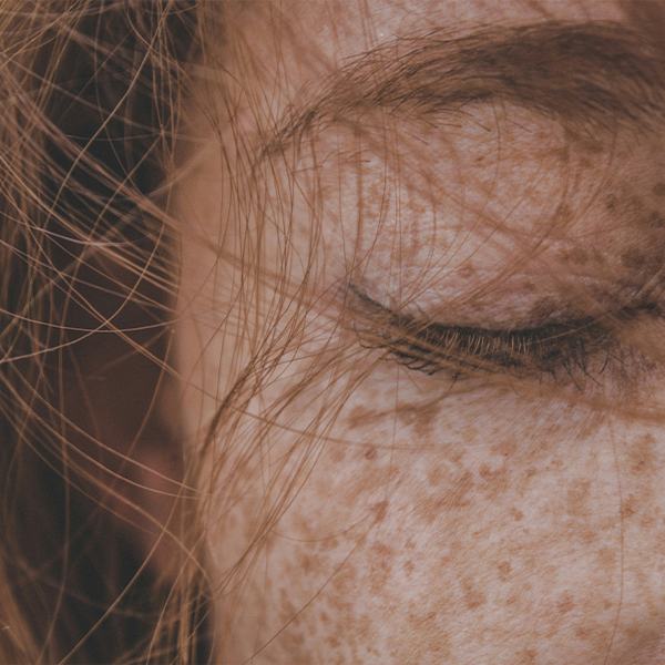Close up of females face with freckles