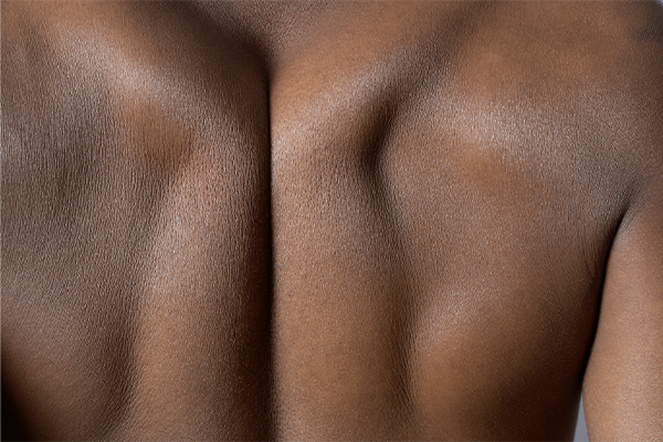 Close up of muscles on back