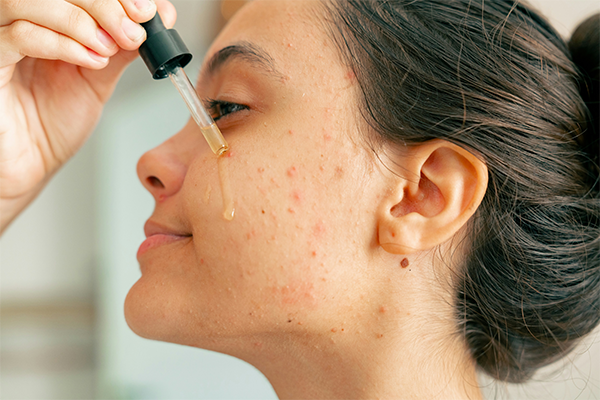 Female applying skin serum on skin