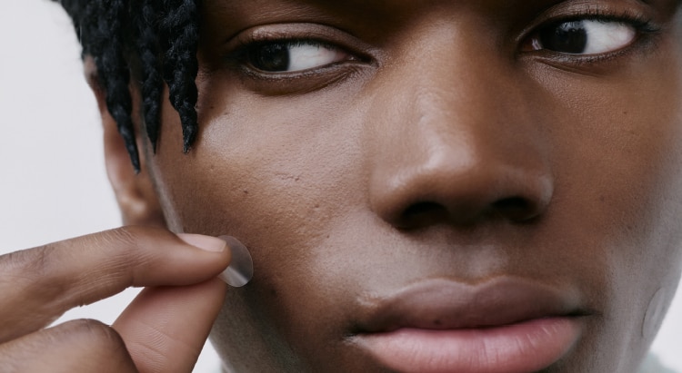 Blemishes